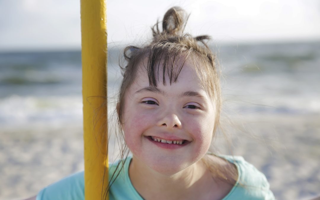 Stamming hos mennesker med Downs syndrom